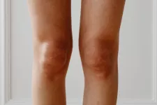 A photo of knees taken from the front